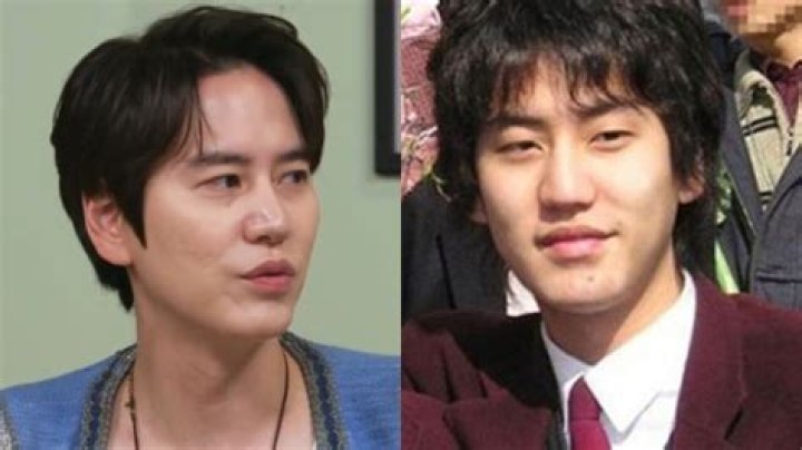 Did Kyuhyun do plastic surgery?