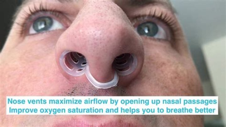 Do max-air nose cones work?