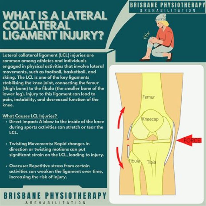 How do I know if I damaged my LCL?