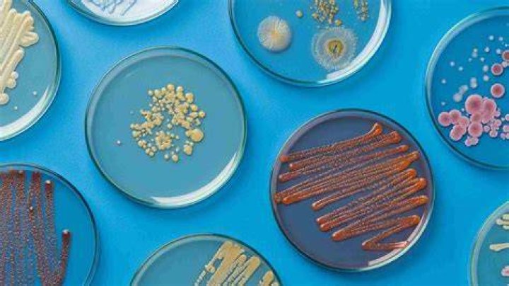 How does bacteria grow in petri dishes?