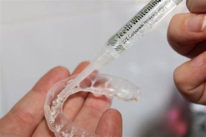 How long do you leave whitening gel on your teeth?
