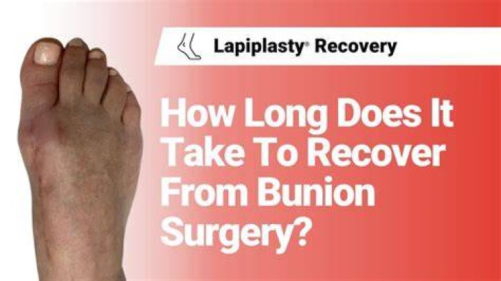 How long is recovery from big toe surgery?