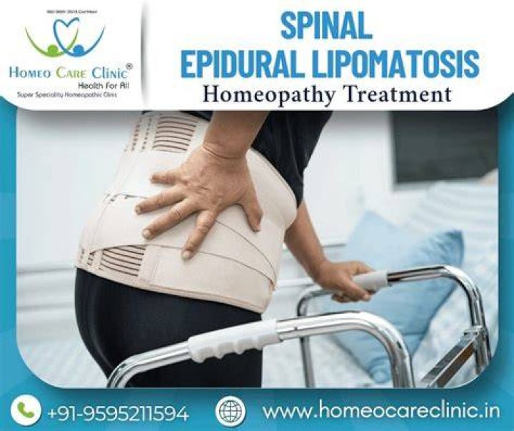 Is epidural lipomatosis rare?