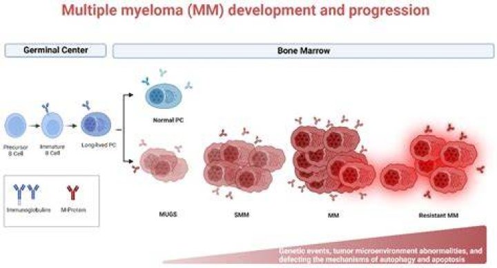 Is multiple myeloma a terminal?
