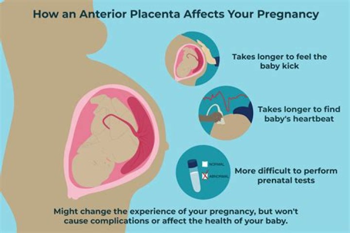 Is normal delivery possible with anterior placenta?
