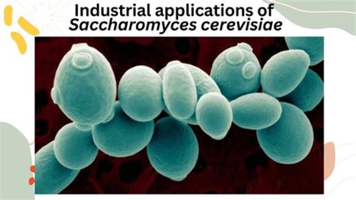 Is Saccharomyces cerevisiae aerobic or anaerobic?