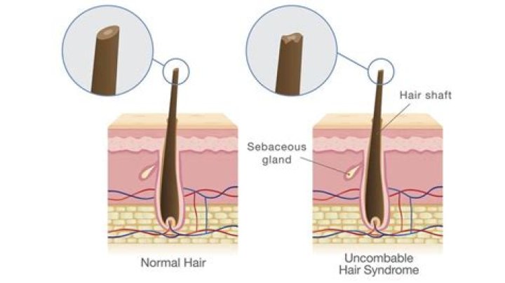 What can I do for uncontrollable hair loss?
