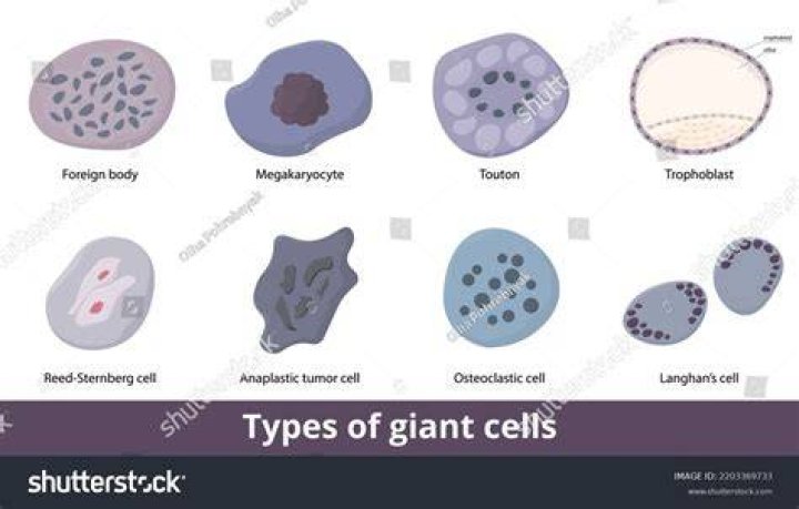 What do giant cells indicate?