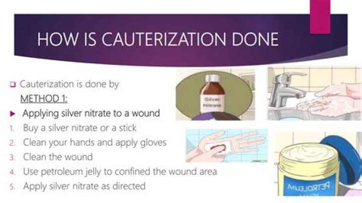 What does silver nitrate do for a wound?