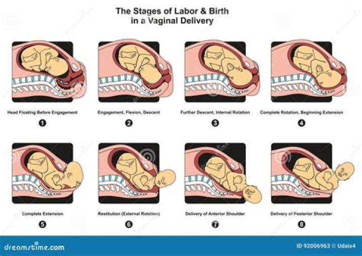 What happens in the Labour Ward?