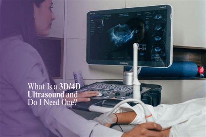 What is a 3D/4D ultrasound?