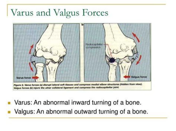 What is valgus and varus force?