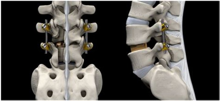 Where does the interspinous ligament attach?