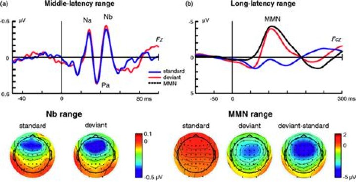 Which is the earliest auditory evoked potential based on latency?