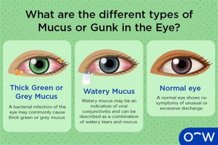 Why do my eyes make so much mucus?