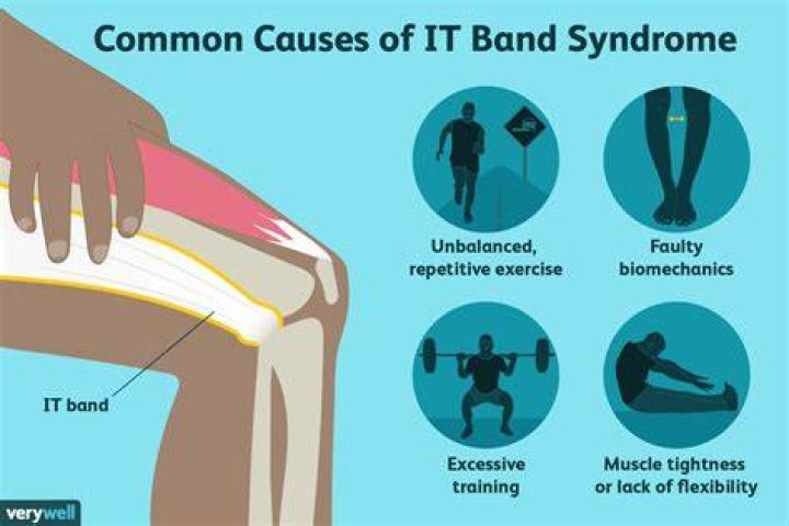 Why does my IT band get tight when I run?