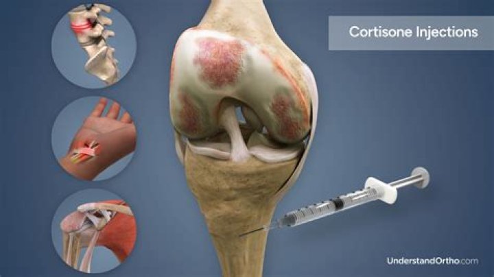Why does my wrist hurt after cortisone shot?