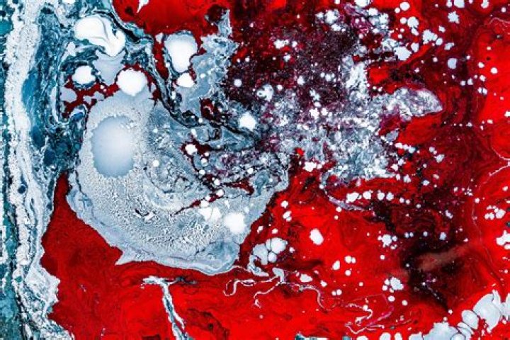 Why was Anacin taken off the market?